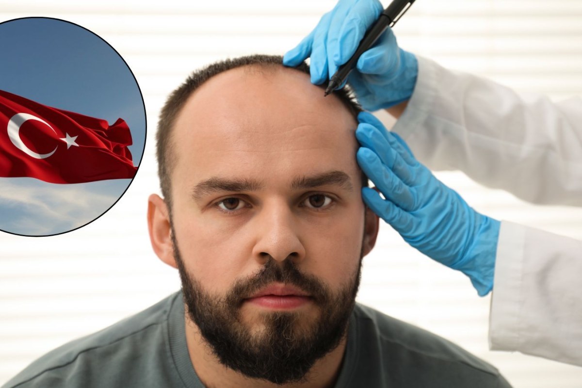 hair transplant clinic