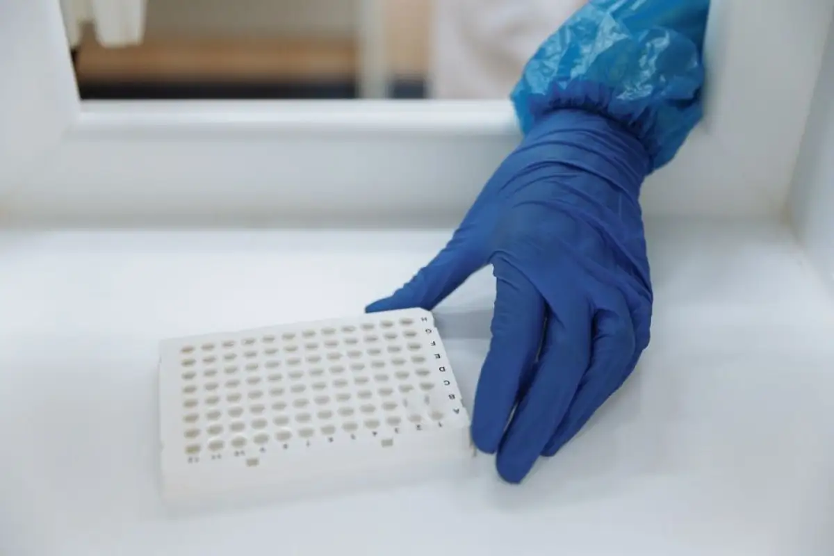 HPV test laboratory